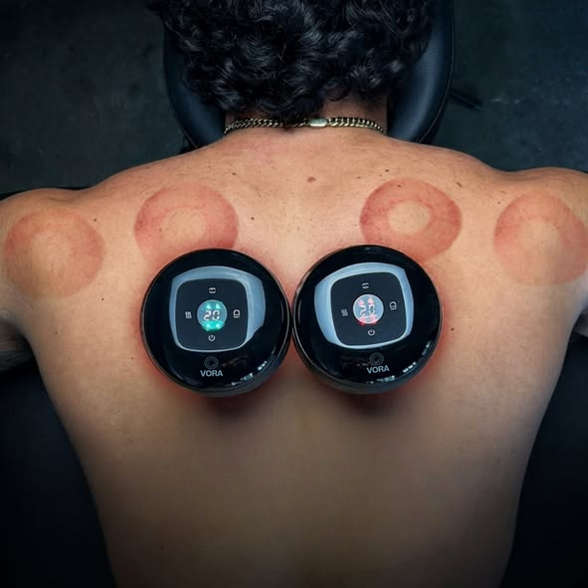 VORA™ Terapia con Ventosas Inteligentes