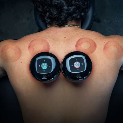 VORA™ Terapia con Ventosas Inteligentes
